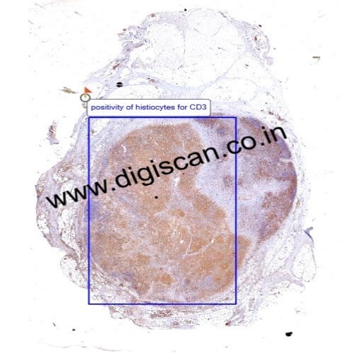 Immunohistochemistry Digital Slides Set (IHC Markers & Cases)